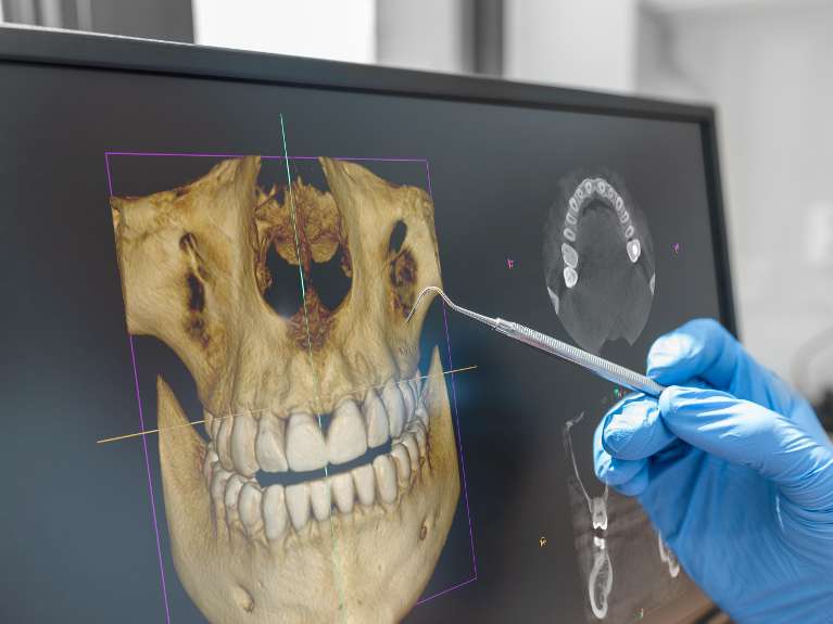 Dentist examining patient's teeth using a CBCT Pradera Dental